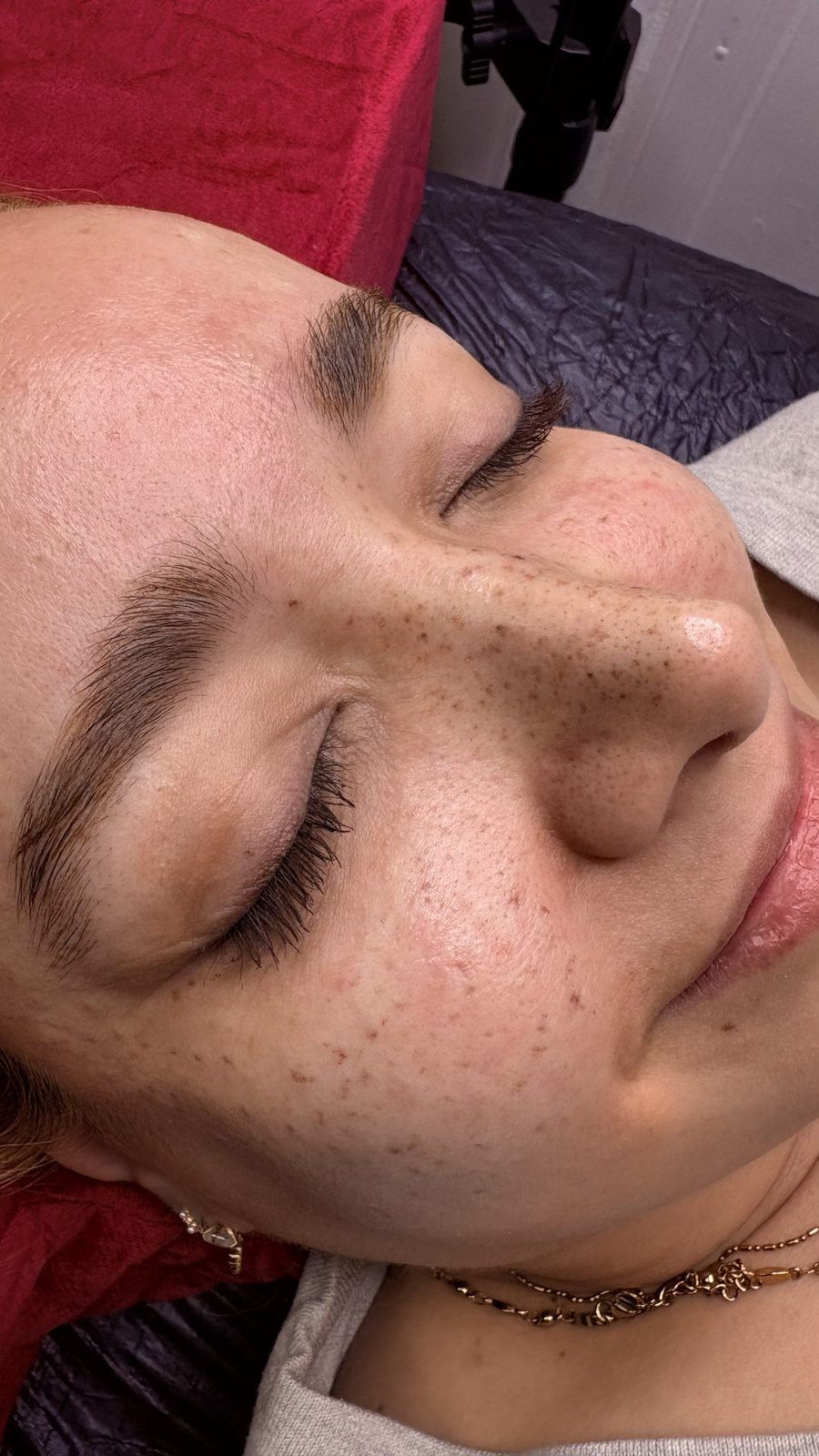 Sommersprossen in Dresden – Soufi Beauty