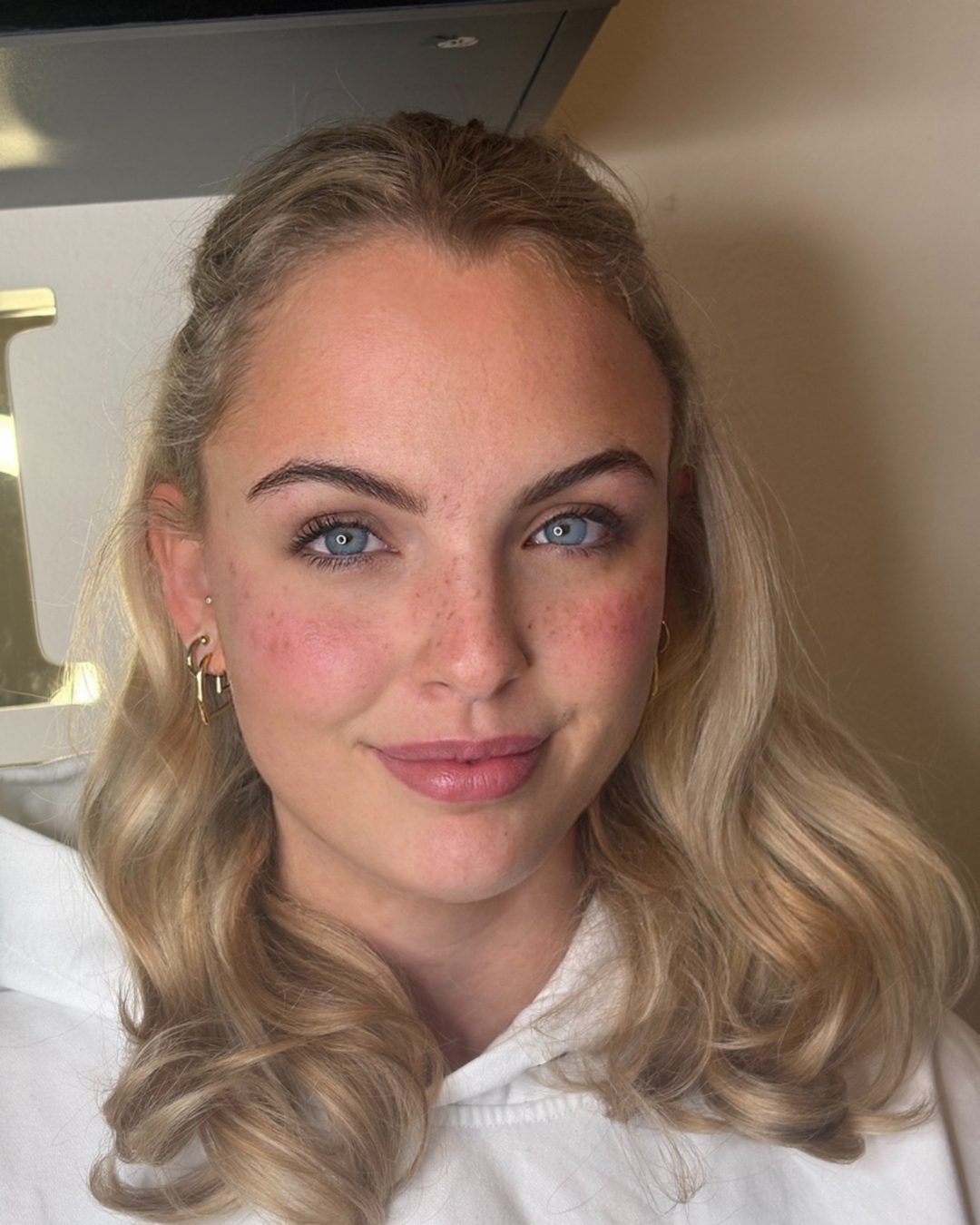 Sommersprossen — Arbeit von Soufi Beauty, Bild 2