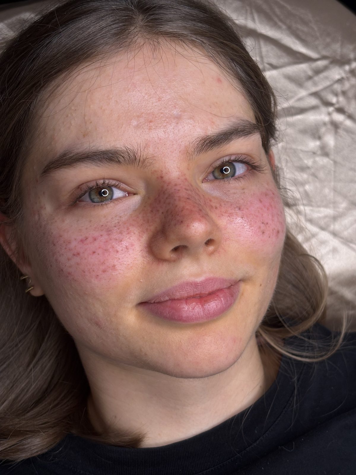 Sommersprossen — Arbeit von Soufi Beauty, Bild 3