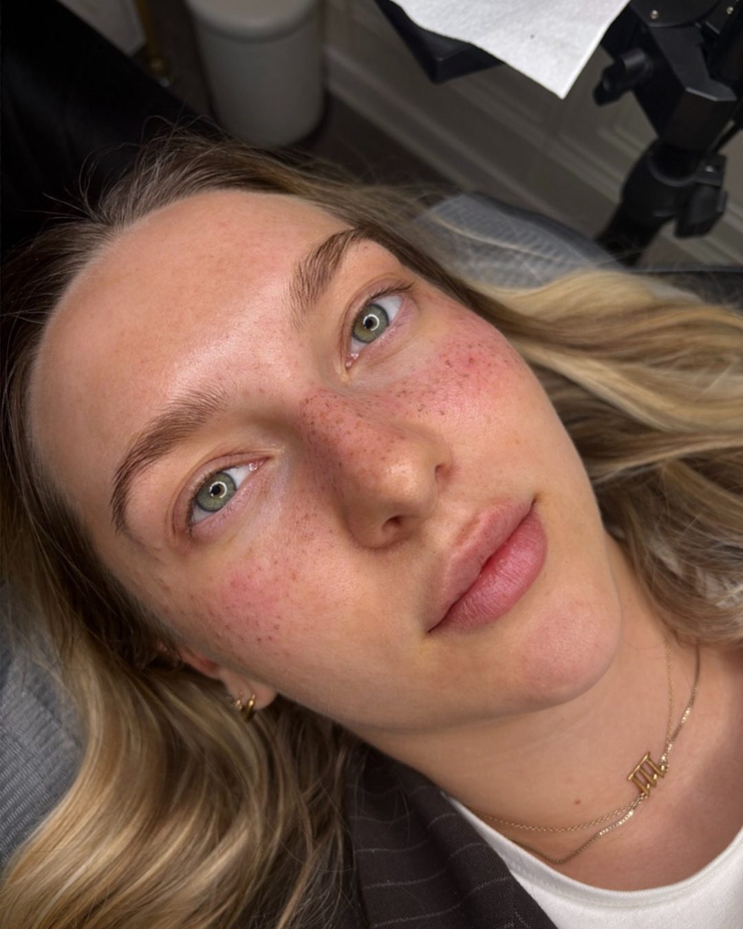 Sommersprossen — Arbeit von Soufi Beauty, Bild 4